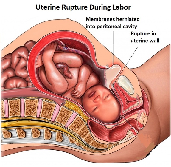 يارب رحمتك الطلق البارد الماسخ اللي ما يجيب الا التعب النفسي تعالو يا تواسع 91038