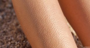 94789 1 310x165 وصفات لحبيبات علاج طرق جلد الوزة البشرة